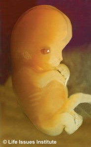Unborn human embryo, 7 weeks after conception