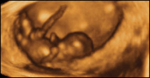"At 8 weeks, this baby can kick and straighten his legs, and move his arms up and down." This and other incredible 4D ultrasound photos can be found here - (Photo credit: Life Dynamics.