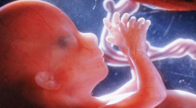 Preborn human at about 16 weeks - estimated time of the attempted abortion of Elisa.