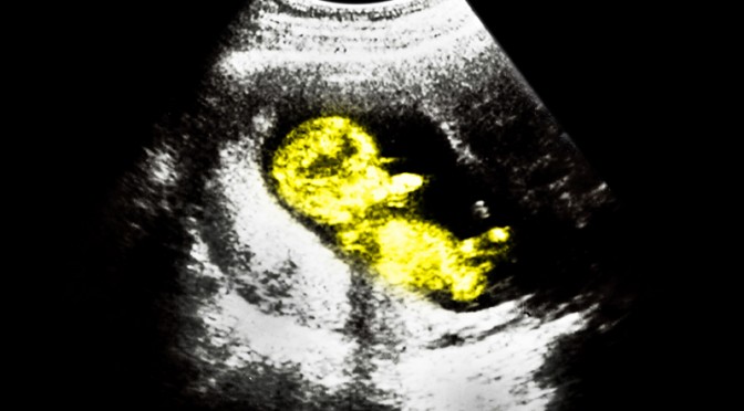 ultrasounds-baby-2-1