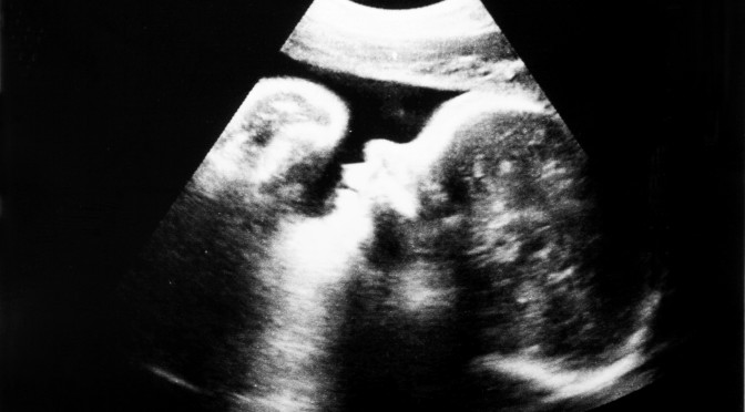 ultrasounds-baby-face