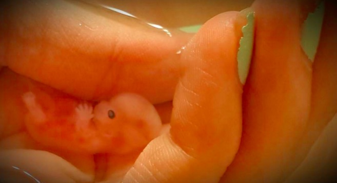 Embryo Sex 87