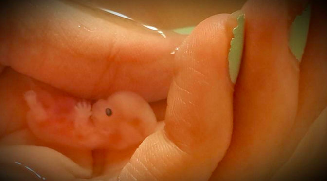 Annabelle, 8 weeks 5 days, fetus, baby, embryo