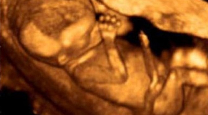 ultrasound-3-D-fetus-baby