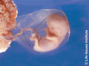 8 week old human fetus