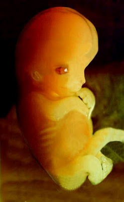 There's actually no more rights you could take away from her. (Human fetus at 7 weeks of development.)