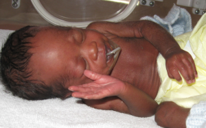 A premature babies served by the International Milk Bank