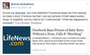 https://blog.lifedynamics.com/mom-reacts-facebook-ban-baby-born-without-nose/